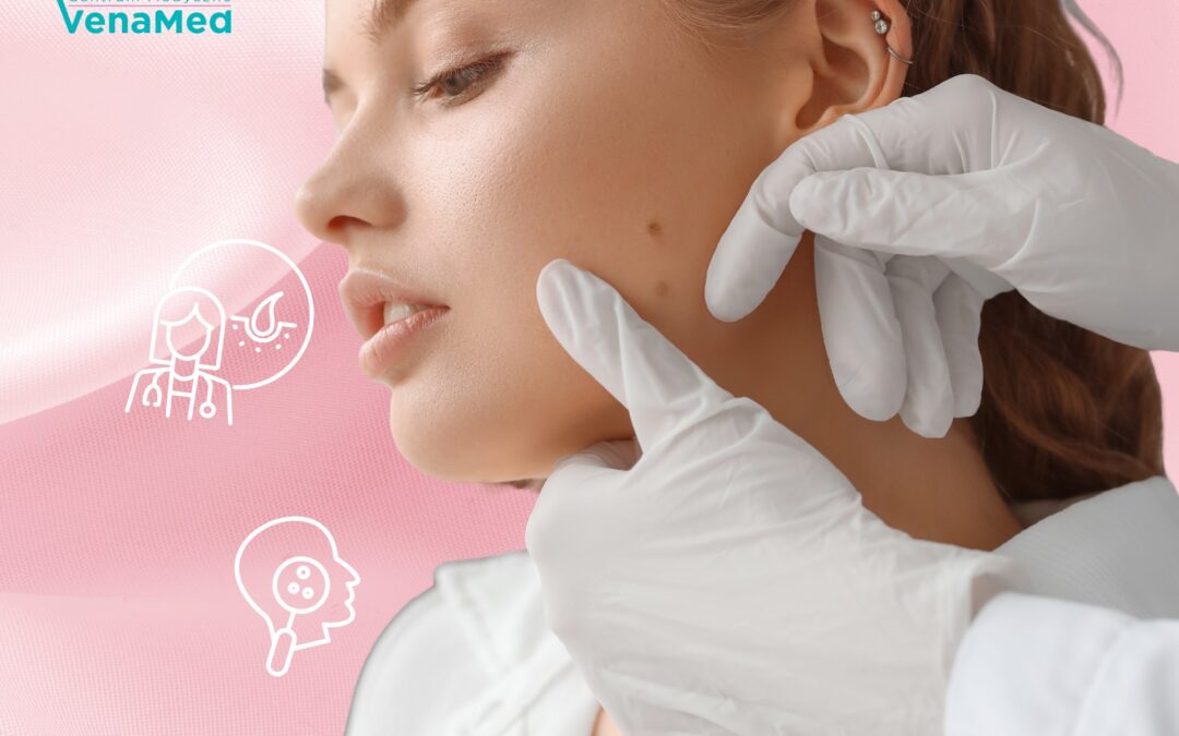 Dermatologia Warszawa