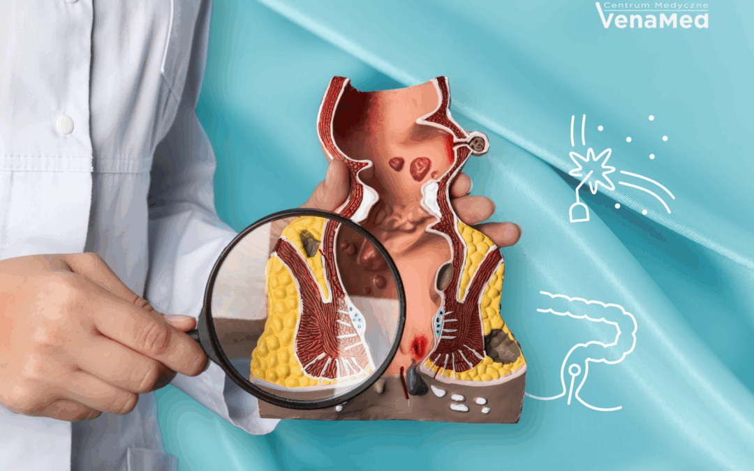 Konsultacja proktologiczna