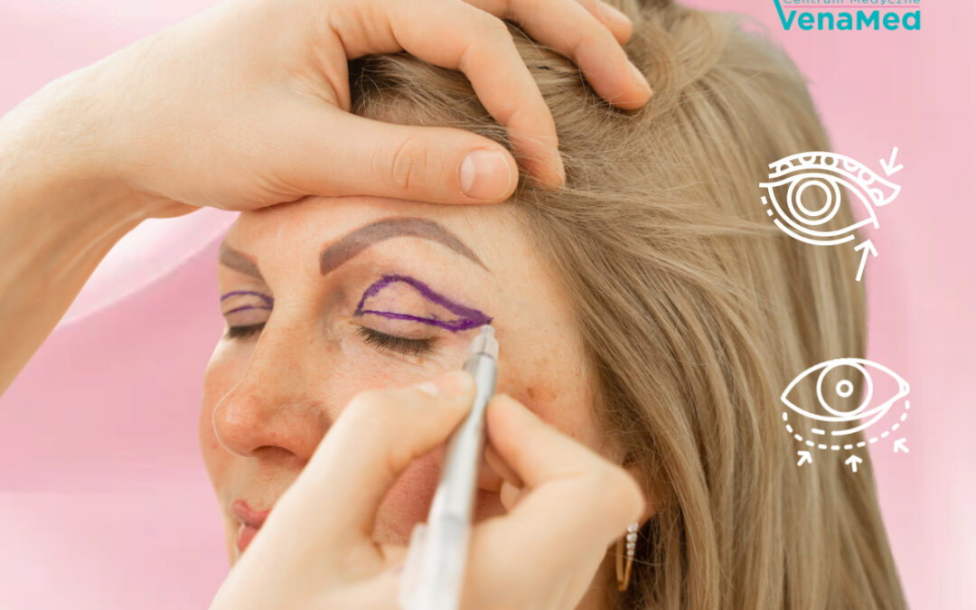 Okuloplastyka powiek