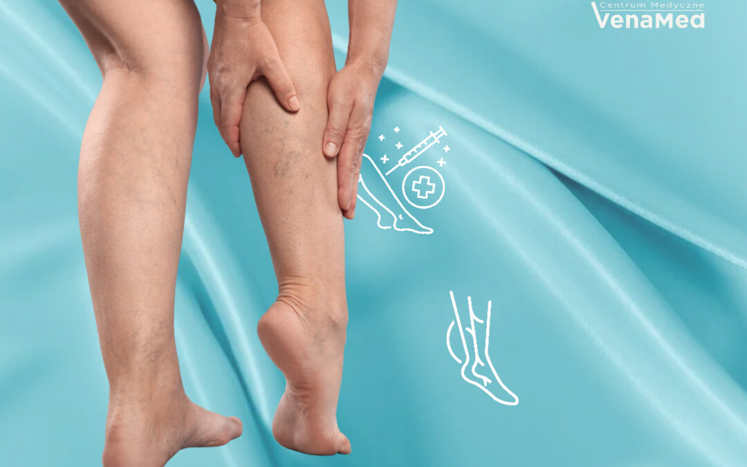 Flebologia w&nbsp;Warszawie