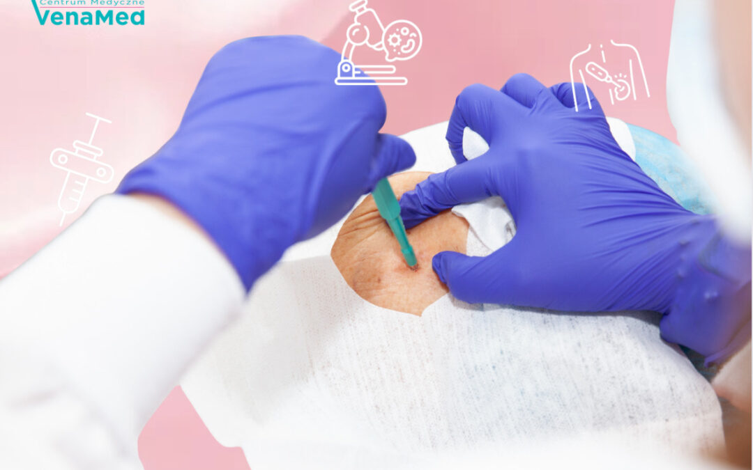 Biopsja gruboigłowa Warszawa – CM&nbsp;VenaMed