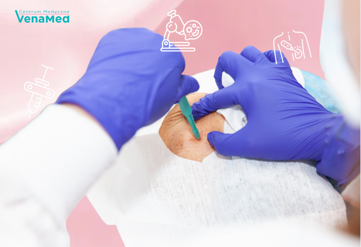Biopsja gruboigłowa Warszawa – CM&nbsp;VenaMed