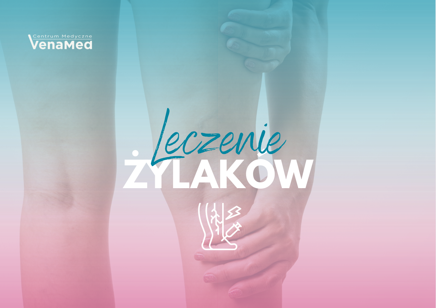Leczenie żylaków