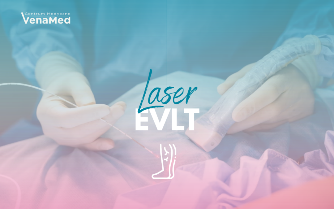 Laser EVLT w&nbsp;CM&nbsp;VenaMed– nowoczesne leczenie żylaków
