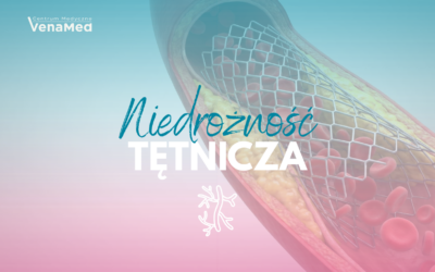 Niedrożność tętnicza – wczesne sygnały, które warto znać