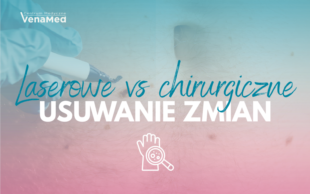 Laserowe czy&nbsp;chirurgiczne usuwanie znamion? 