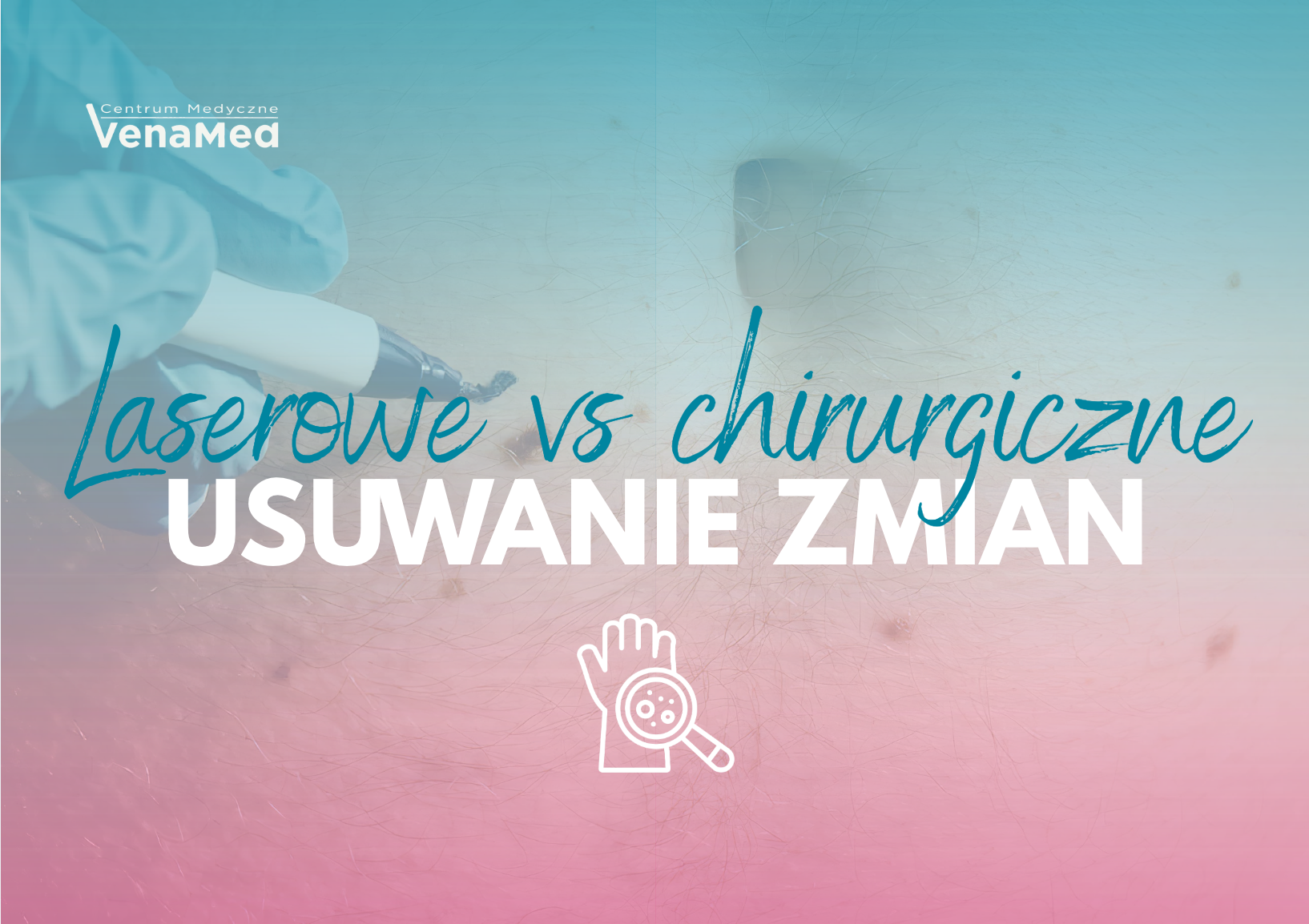 Laserowe czy chirurgiczne usuwanie znamion?