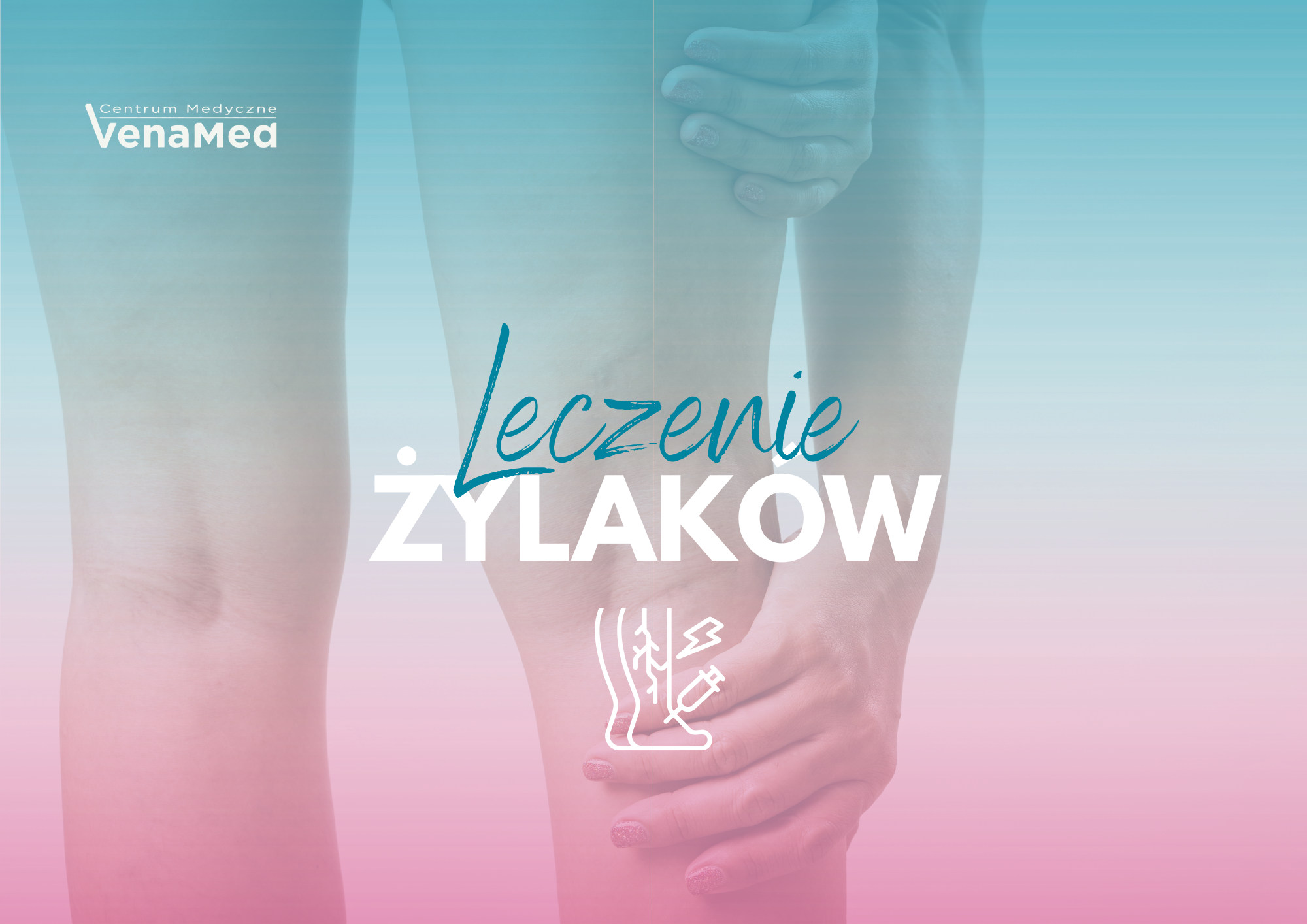 Skleroterapia i nowoczesne leczenie żylaków w Warszawie – jak skutecznie zadbać o zdrowe nogi?