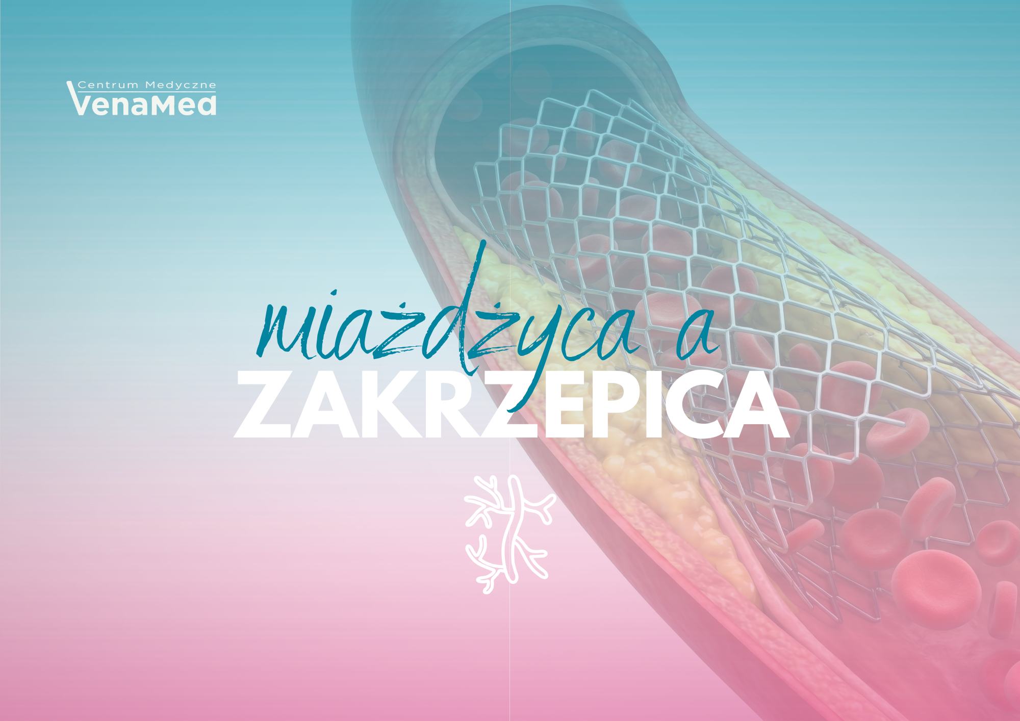 Miażdżyca a zakrzepica – czym się różnią i jak pomaga diagnostyka USG Doppler?