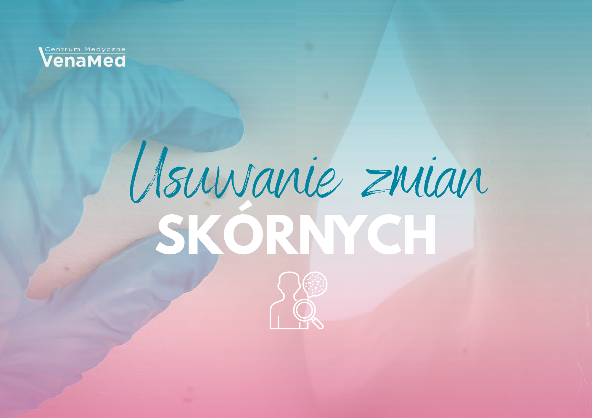 Chirurgiczne usuwanie zmian skórnych przed okresem wakacyjnym – bezpieczna diagnostyka i profilaktyka