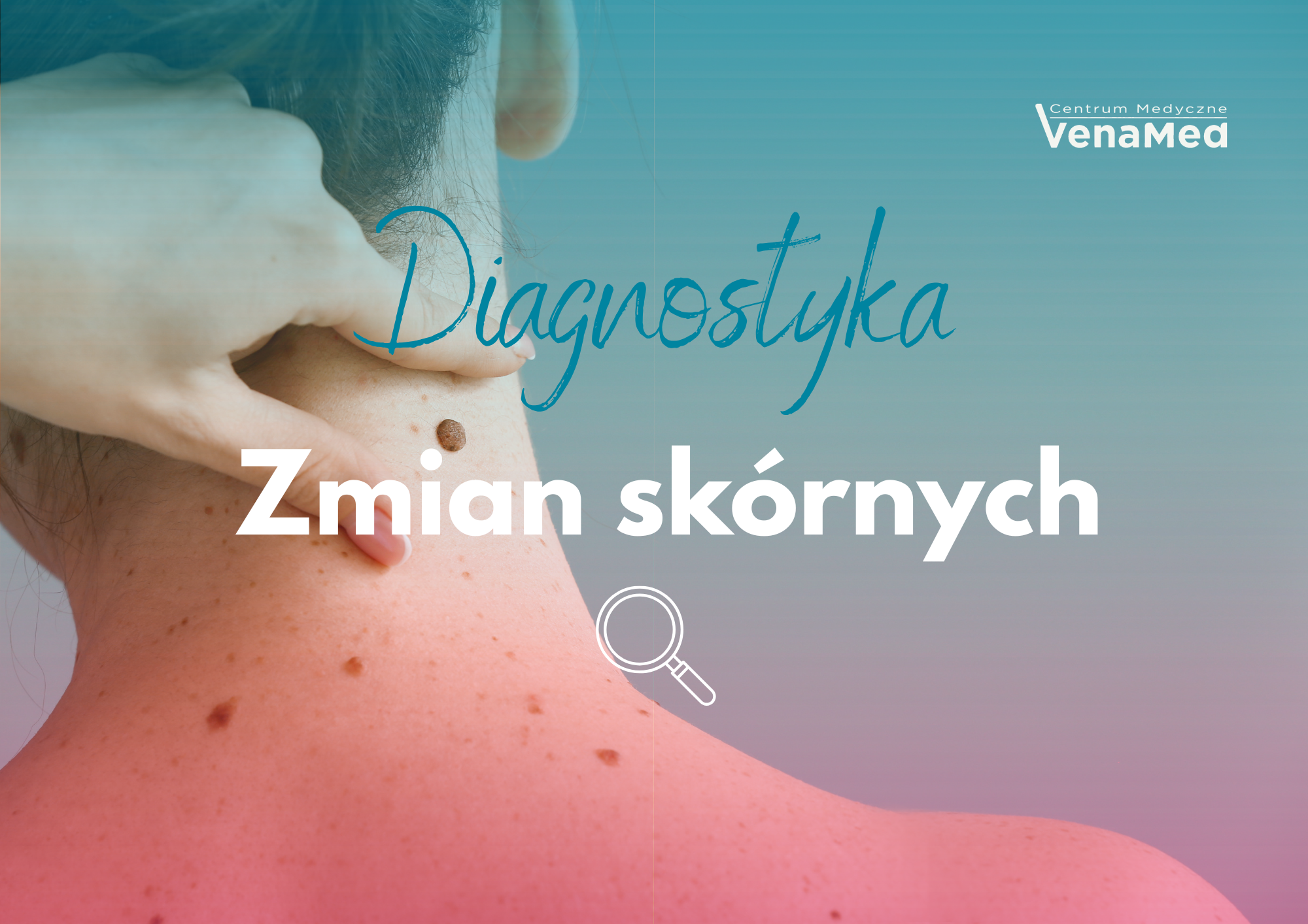 Diagnostyka zmian skórnych latem – kiedy zbadać znamię i jak bezpiecznie usunąć zmianę na skórze